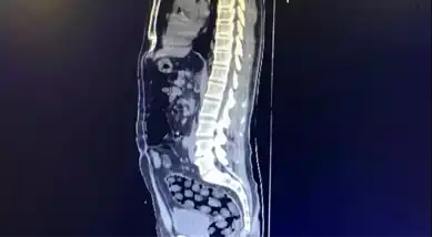 Bitlis'te İranlılardan 1 Kilo Metamfetamin Ele Geçti