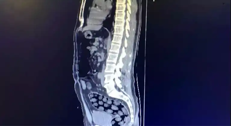 Bitlis'te İranlılardan 1 Kilo Metamfetamin Ele Geçti